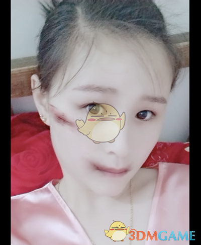 抖音脸上受伤的妆特效拍摄方法介绍